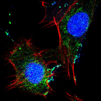 PCSK9 Antibody