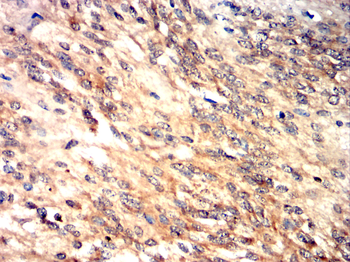 PCSK9 Antibody