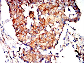 PDCD6IP Antibody