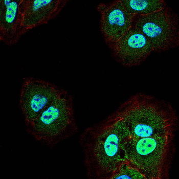 RB1 Antibody