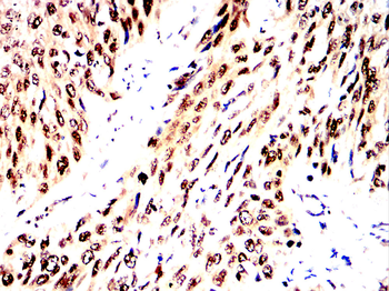 RB1 Antibody