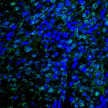 RB1 Antibody
