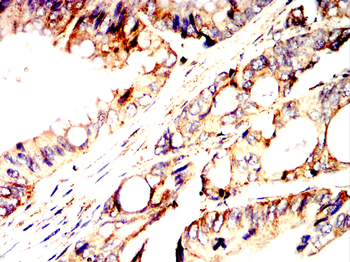 SOD2 Antibody