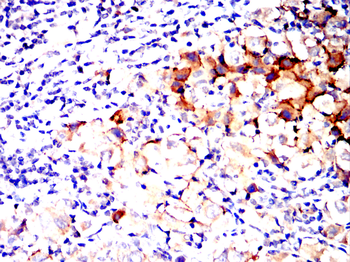CSPG4 Antibody