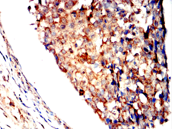 IFNG Antibody