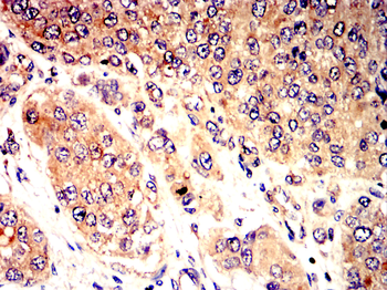 VEGFA Antibody