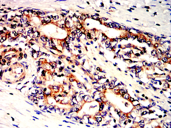 VEGFA Antibody
