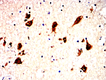 CCR7 Antibody
