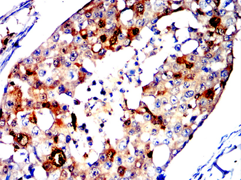 S100A4 Antibody
