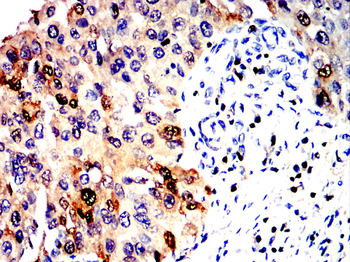 S100A4 Antibody
