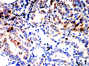 S100A4 Antibody