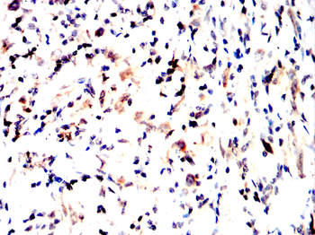 MERTK Antibody