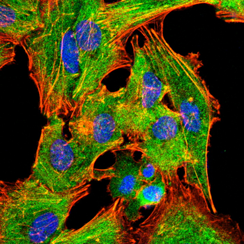 IRAK4 Antibody