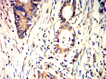 IRAK4 Antibody