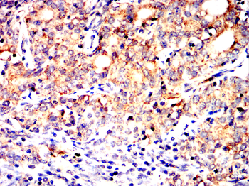 CD36 Antibody