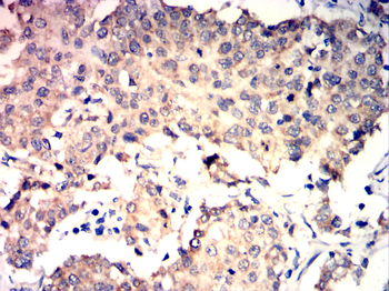 AKT2 Antibody