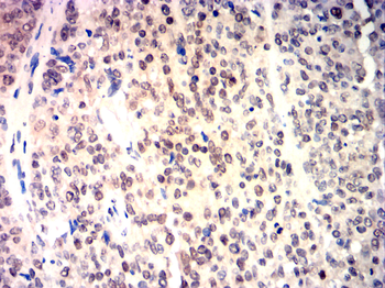 CHEK2 Antibody