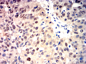 CHEK2 Antibody