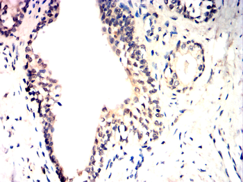 CHEK2 Antibody