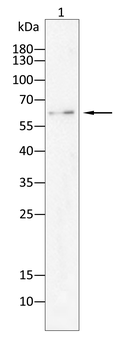 CHEK2 Antibody