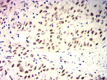 KDM1A Antibody