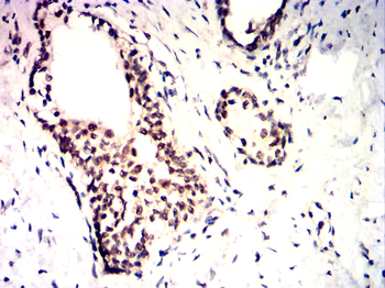 KDM1A Antibody