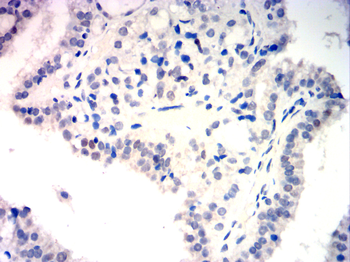 MSH6 Antibody