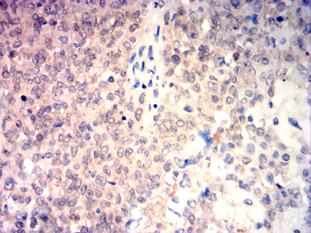 PAK2 Antibody