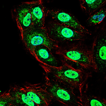 CCNE2 Antibody