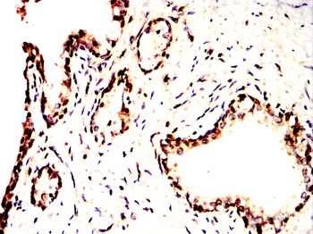 VDR Antibody