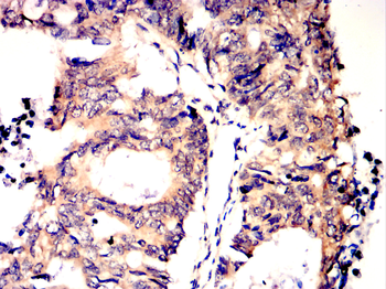 BBC3 Antibody