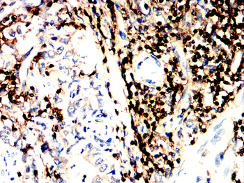 PTPRC Antibody