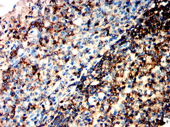 PTPRC Antibody