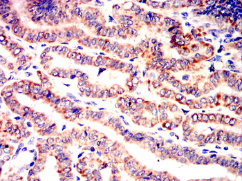 CCR2 Antibody
