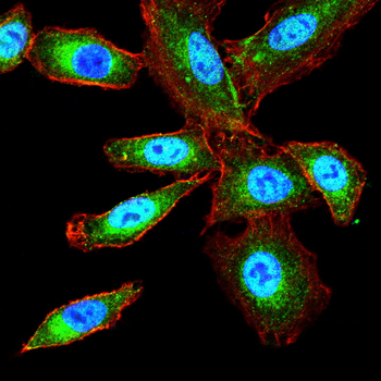 IFNAR1 Antibody