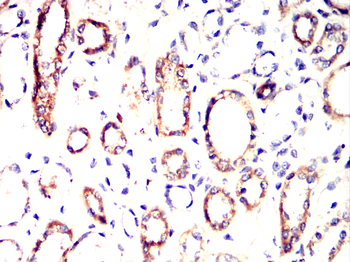 IFNAR1 Antibody