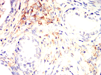 IFNAR1 Antibody