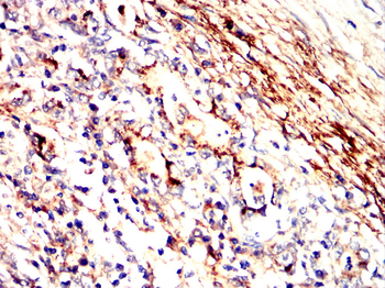 IFNAR1 Antibody