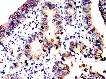 TARDBP Antibody