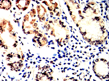 TARDBP Antibody