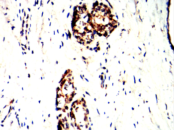 CDK5 Antibody