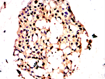 CDK2 Antibody