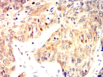 CDK2 Antibody