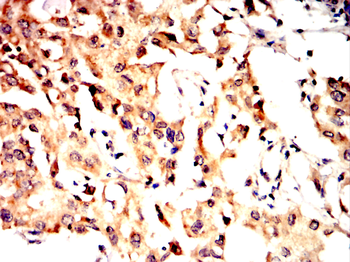 CDK2 Antibody