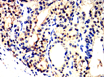 STAT3 Antibody
