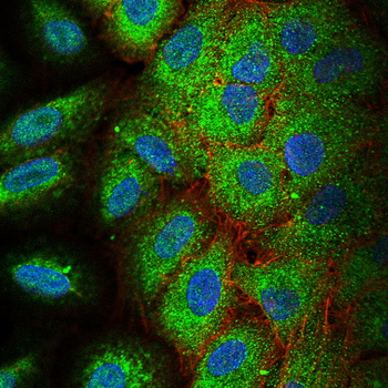 FN1 Antibody