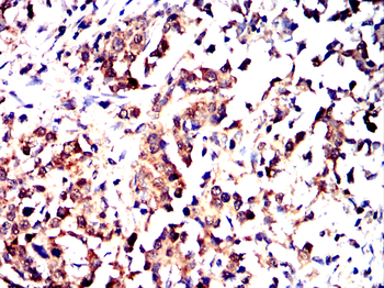 FN1 Antibody