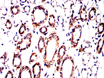 FN1 Antibody