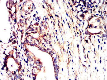 FN1 Antibody