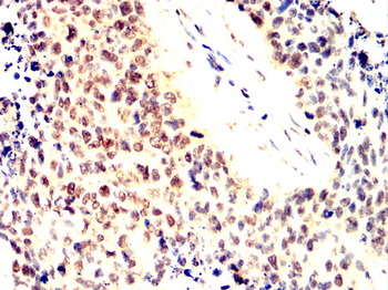 SMAD3 Antibody